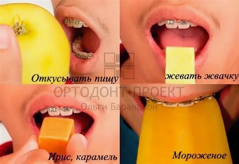 Можно есть чипсы с брекетами. Можно есть чипсы с брекетами
