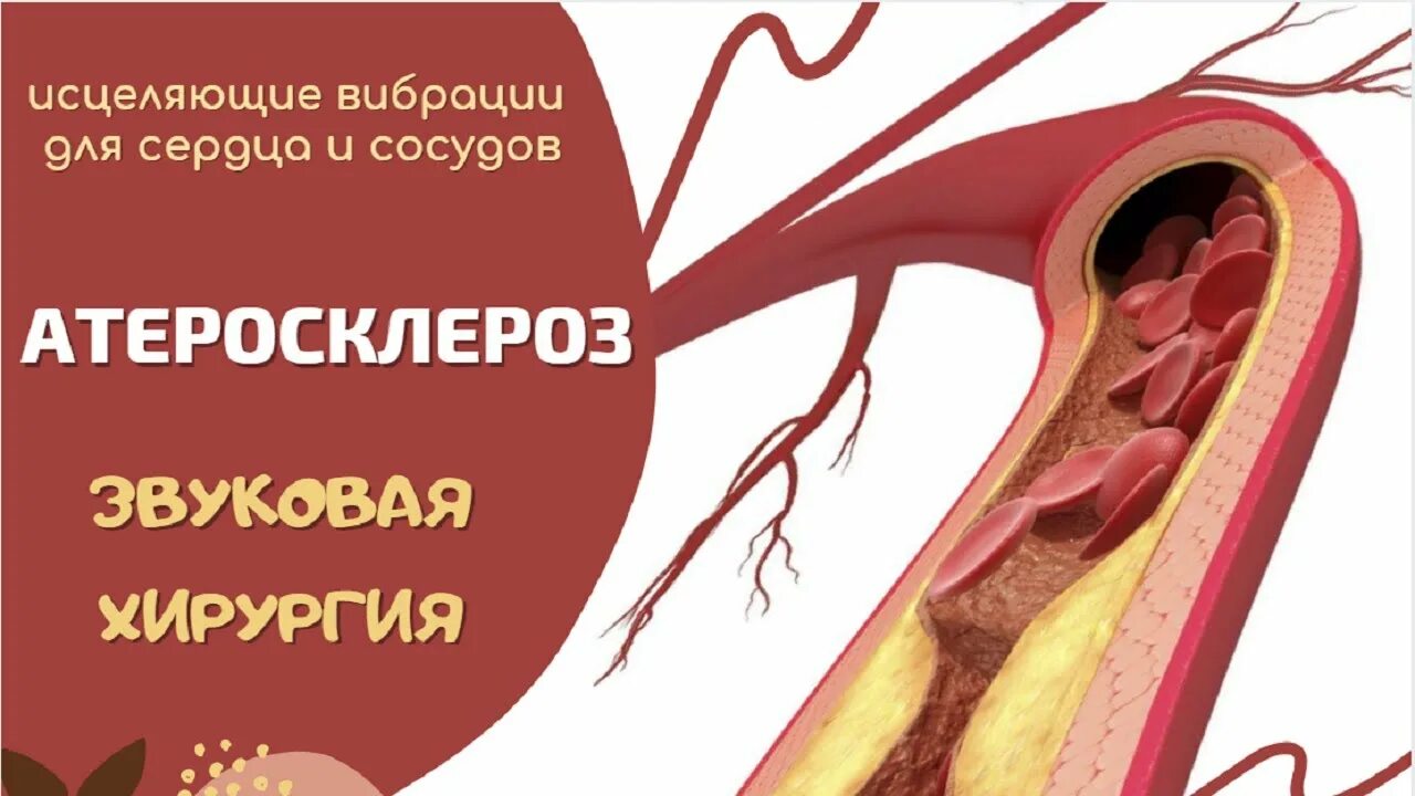 исцеление сердца и сосудов медитация. исцеление звуком сердце. медитации исцеление мозга. лечение звуком и вибрациями. влияние массажа на сердечно-сосудистую систему.