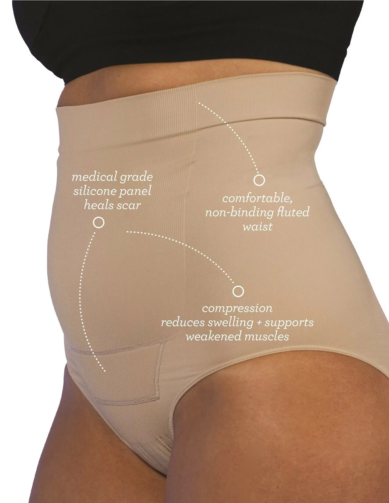 Гистерэктомия бандаж послеоперационный. Бандаж абдоминальный крейт б-305. Бандаж после гинекологической полостной операции. Бандаж после операции на матке. Бандаж после операции по удалению матки.