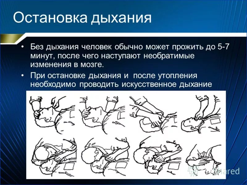 Рефлекторная остановка дыхания