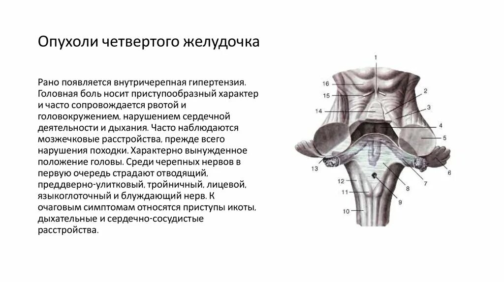 Опухоли желудочков. Опухоли 4 желудочка головного мозга классификация. Объемное образование 4 желудочка. Опухоли 4 желудочка клиника. Образование 4 желудочка мозга.