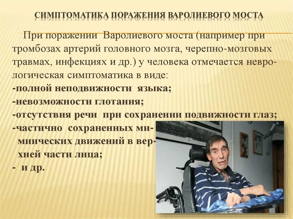 Симптомы поражения моста. Поражение моста мозга симптомы. Симптомы поражения варолиева моста. Синдромы поражения моста мозга. Проявить поражать