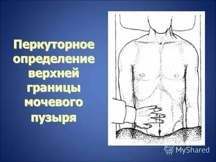 Границ верхнего и нижнего уровней