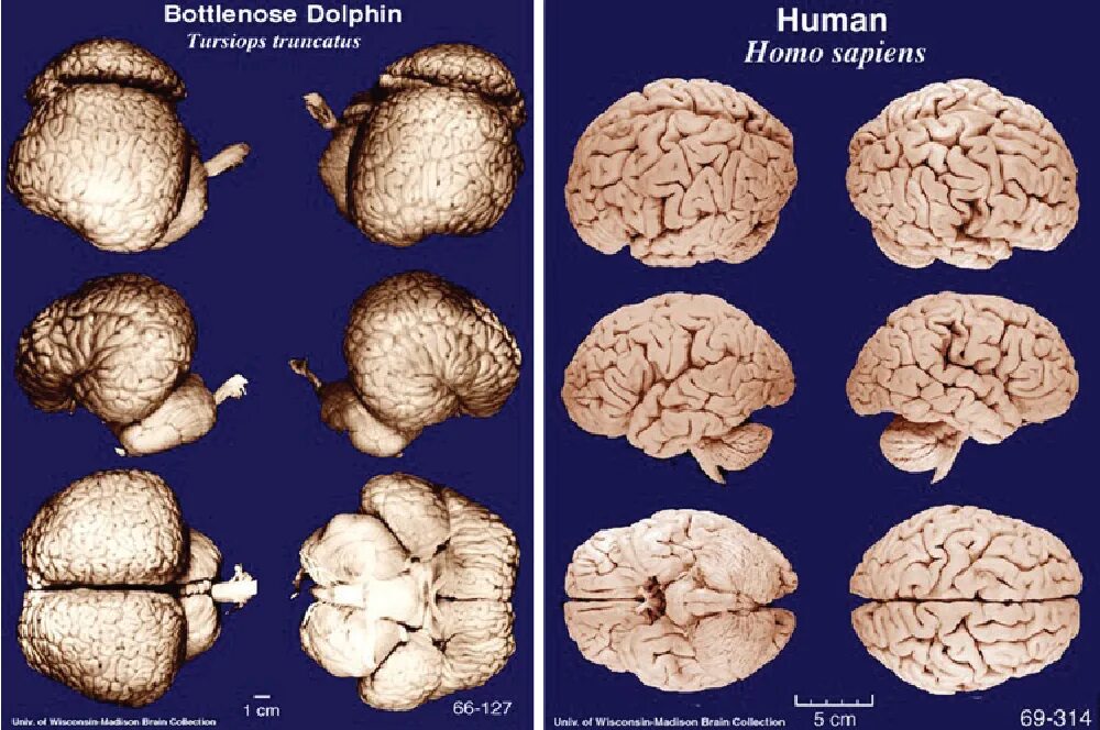 Объем головного мозга наибольшее. Мозг дельфина и мозг человека. Размер мозга человека и дельфина. Мозг дельфина и человека сравнение.