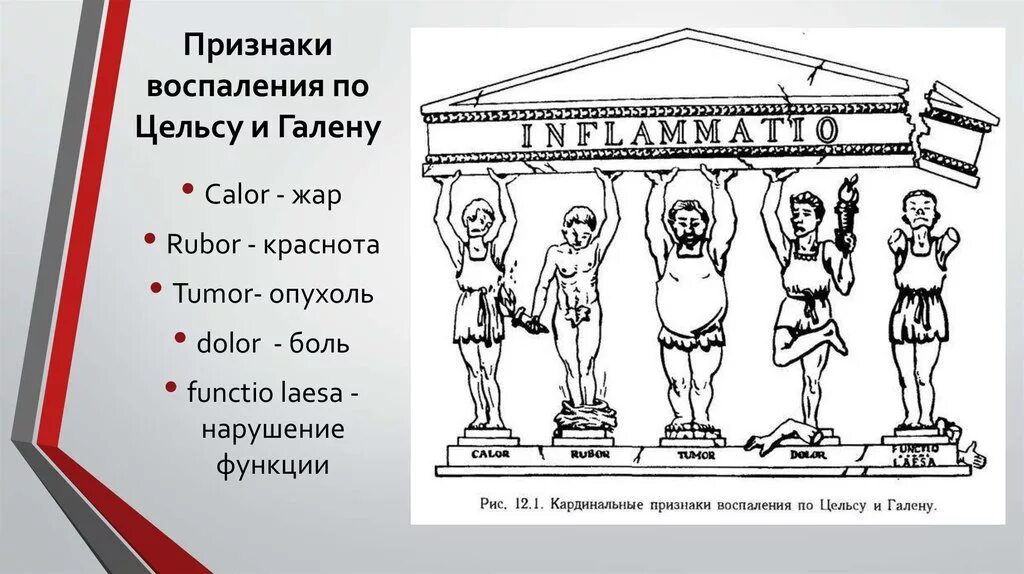 Признак воспаления dolor. Признаки воспаления 5 признаков. Признаки воспаления по Цельсу. Местные признаки воспаления. Признаки воспаления на латинском.