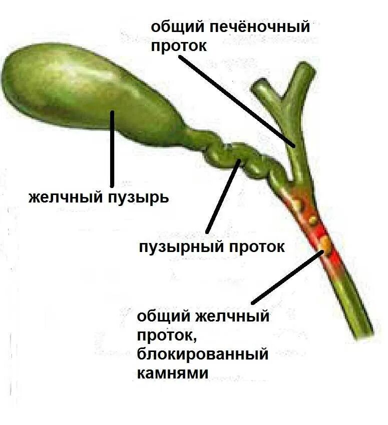 Желчный пузырь гомогенное что значит