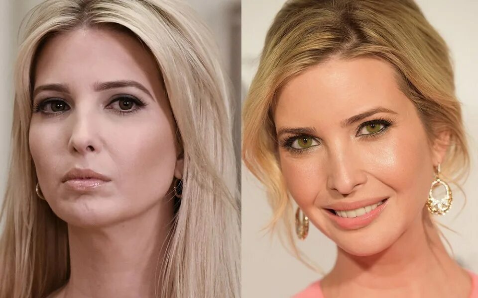 Иванка до пластики. Ivanka Trump в молодости. Иванка Трамп до пластики. Иванка Трамп глаза. Иванка Трамп цвет глаз.