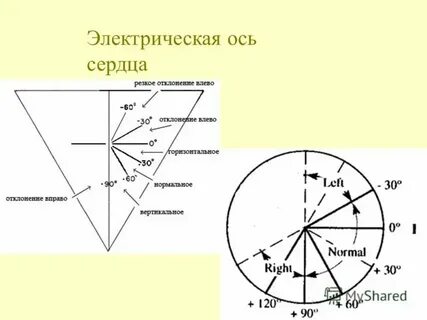 Эос ртк