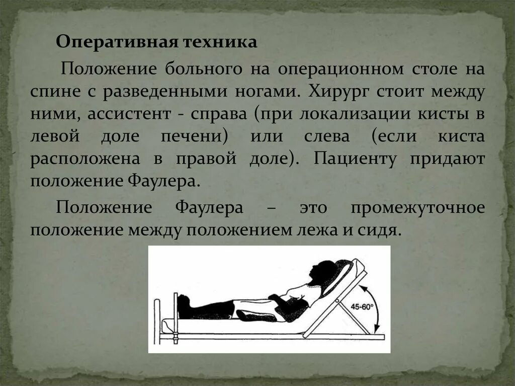 Положение больного на столе. Положение больного на операционном столе. Положение Фаулера. Положение Фаулера на операционном столе. Положение лежа на спине больного на операционном столе.