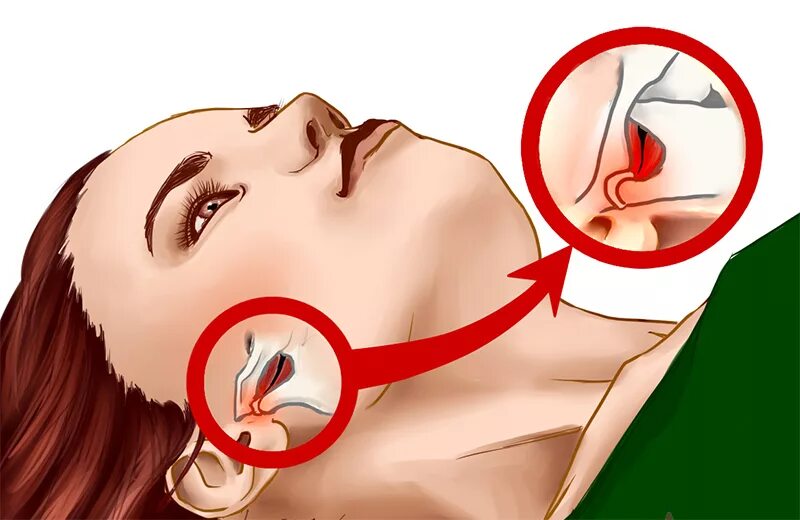 щелкает левая челюсть