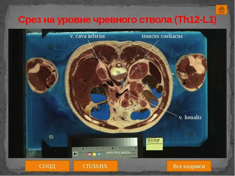 Срез работ. Поперечный срез тела человека. срезы в анатомии.