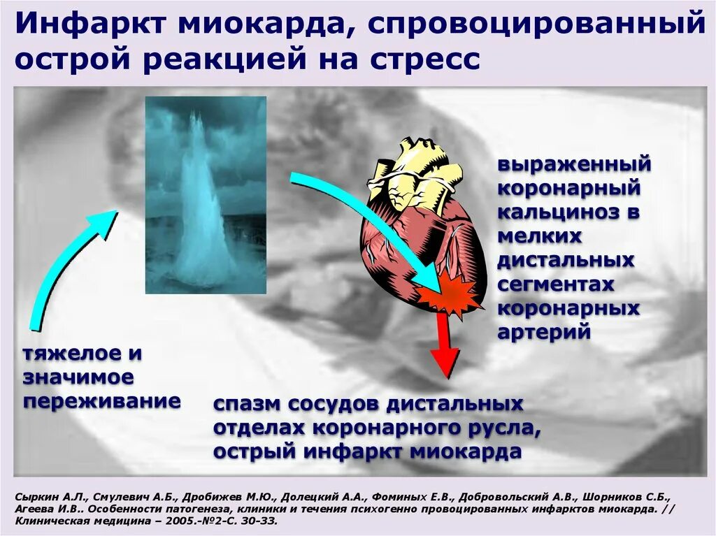 Смерть после стресса. Стресс и инфаркт миокарда. Факторы риска острого инфаркта миокарда.