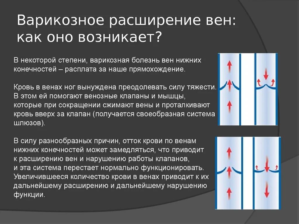 Мкб варикозная болезнь вен нижних. Варикозная болезнь нижних. Варикозная болезнь вен нижних конечностей презентация. Степени варикозного расширения нижних конечностей. Варикозная болезнь нижних конечностей презентация.