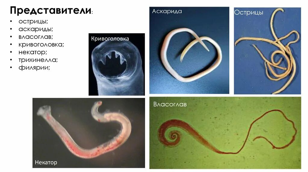 Какой вред могут причинять взрослые аскариды организму. Кривоголовки гельминты.