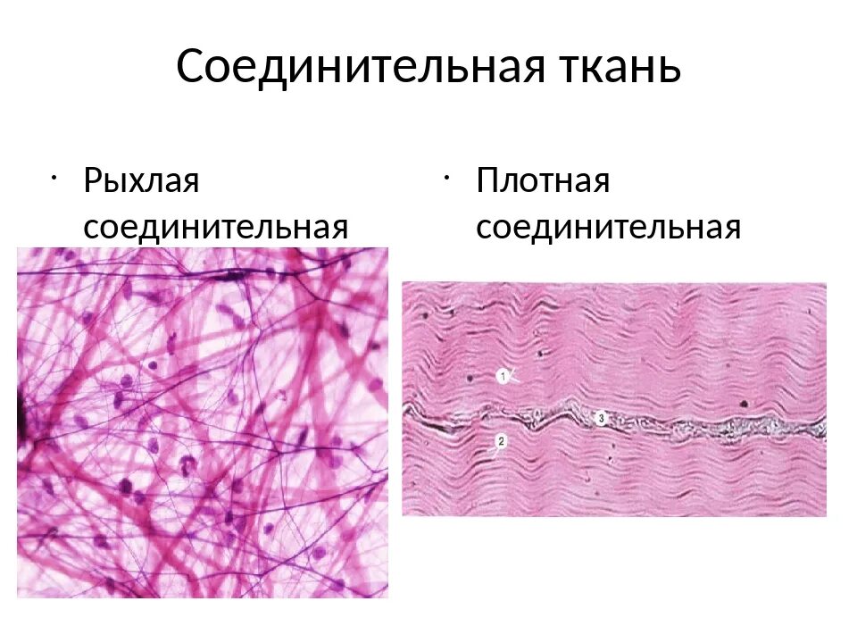 Какие органы входят в соединительную ткань. Плотная волокнистая соединительная ткань схема. Собственно соединительная ткань рыхлая. Рыхлая волокнистая и плотная волокнистая соединительная ткань. Клетки плотной волокнистой соединительной ткани.