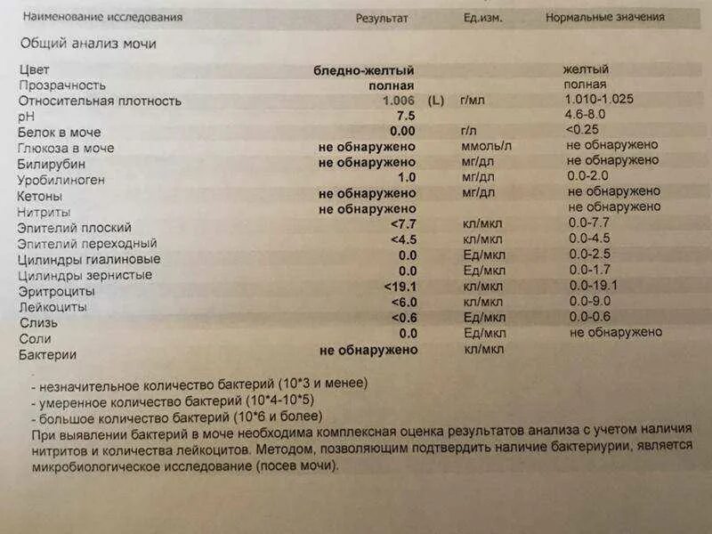 Анализ мочи. Общий анализ мочи. Общий анализ мочи при. Плохой анализ мочи.