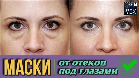 Как убрать отек с лица утром быстро