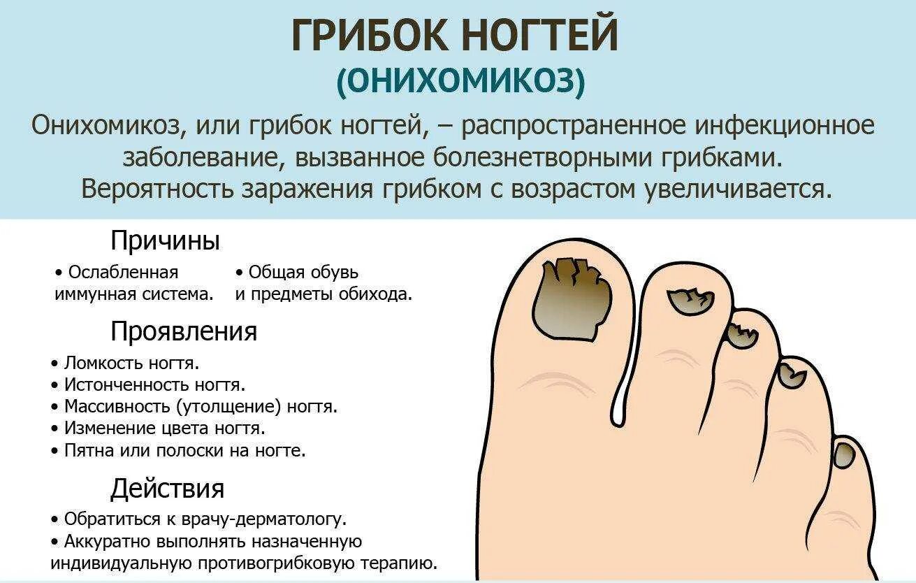Что значит ногтях. Грибковые заболевания ногтей схема. грибковые заболевания ногтей ног. грибок ногтей на ногтях ног.