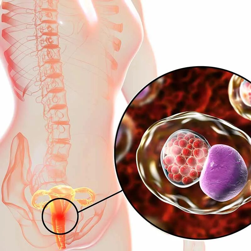Хламидия в организме. Хламидийная инфекция аноректальной области. Хламидия у женщин фото.