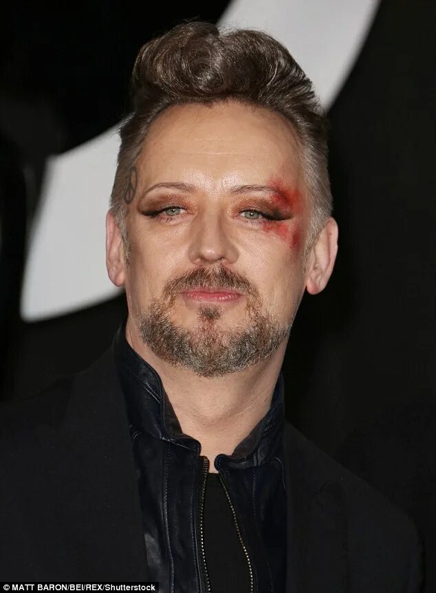 Знаменитости с синяками под глазами. Иллюминаты люди. Синяк под глазом масоны. Галкин с синяком под глазом. Папа римский франциск с синяком.