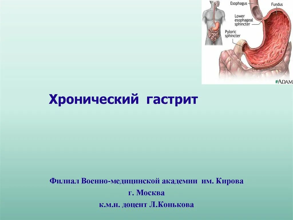 Формы хронического гастрита. Синдромы хронического гастрита. Хронический гастрит презентация.