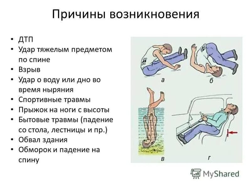 Удар поясницей. Перечислите органические повреждения позвоночника. Травматическое повреждение спинного мозга реабилитация. Травма позвоночника, спины.