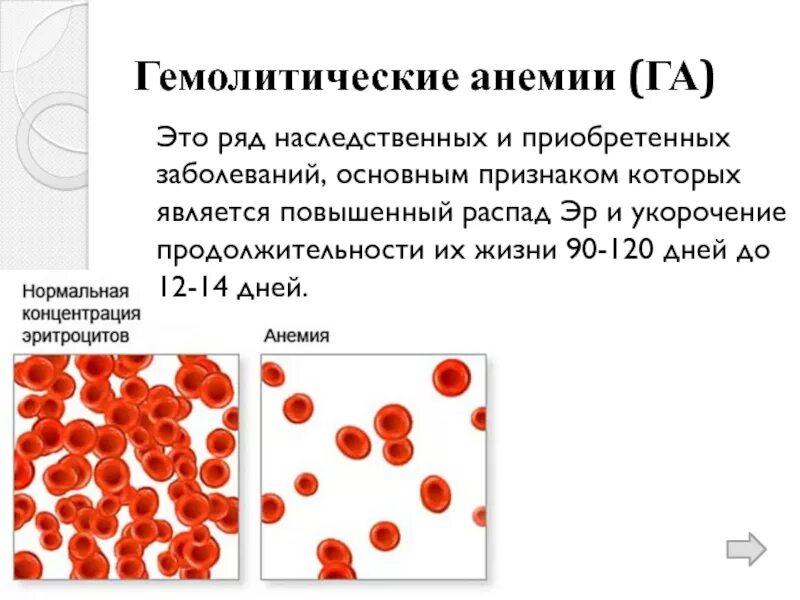 Врожденные гемолитические анемии. Приобретенные гемолитические анемии показатели \. Кровь при приобретенных гемолитических анемиях. Картина крови при наследственной гемолитической анемии. Приобретенная гемолитическая анемия картина крови.