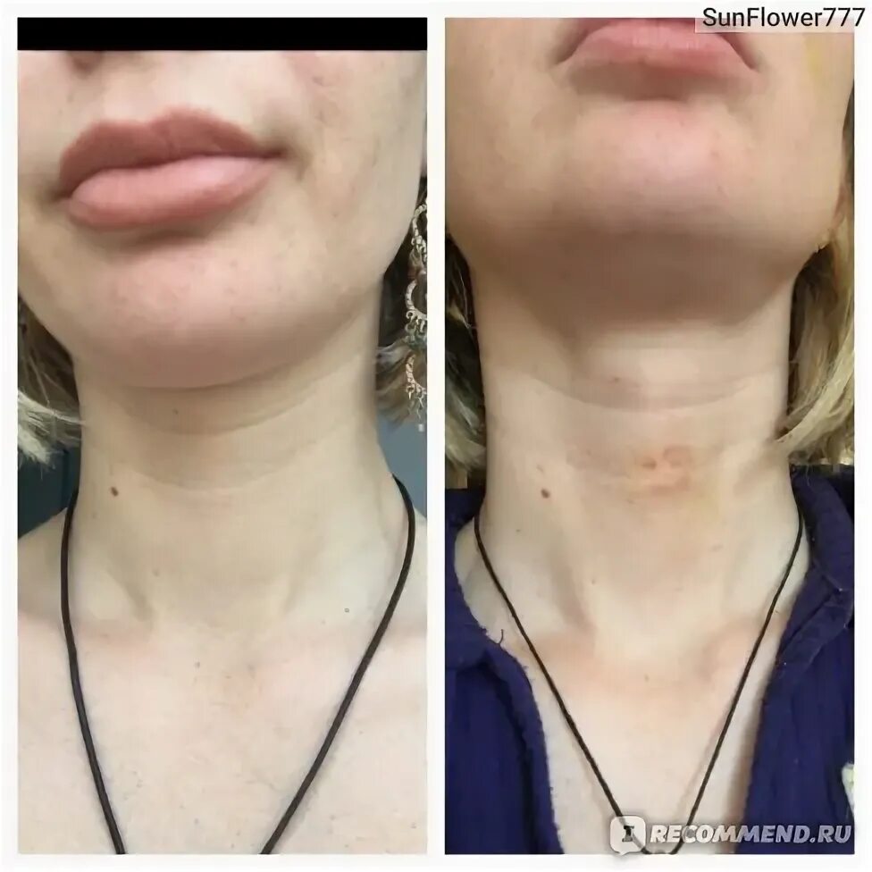 Гелевый увлажняющий воротник для шеи Gel Neck Wrap