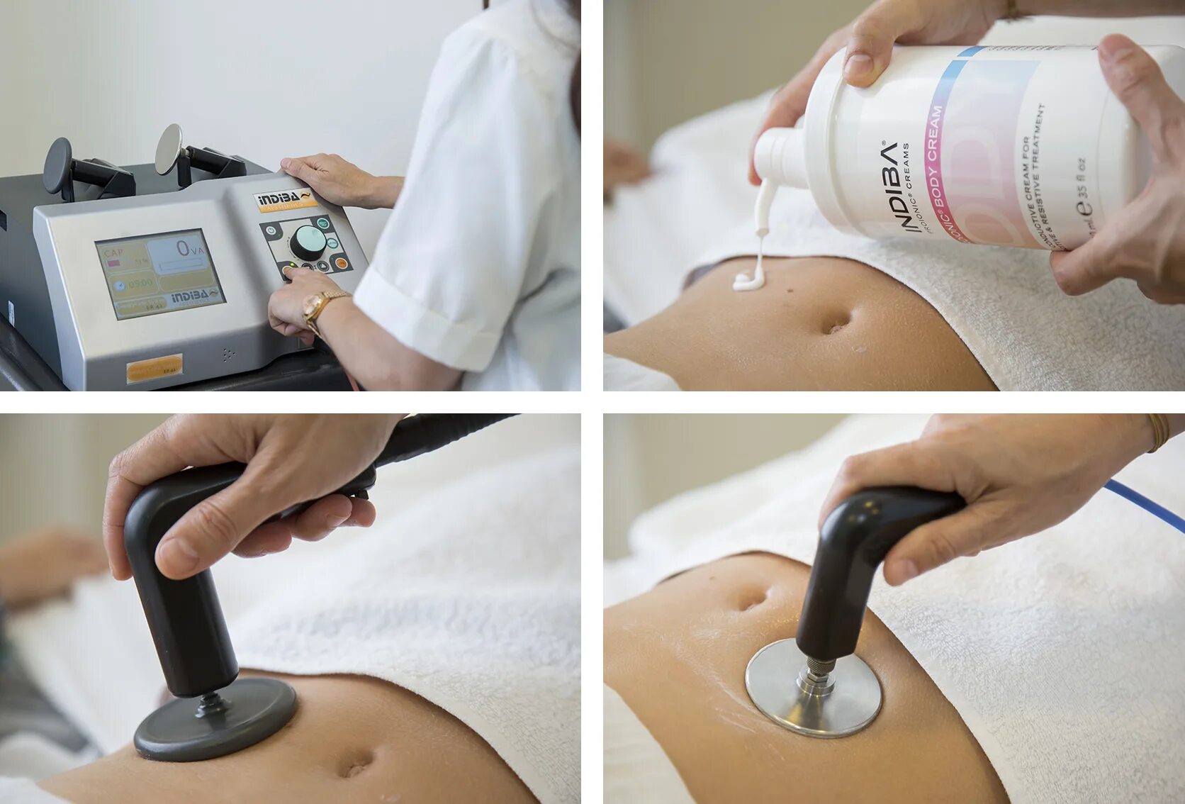 Аппарат индиба в косметологии. Индибо терапия. Индиба физиотерапевтический аппарат. Терапия indiba. Индибо терапия.