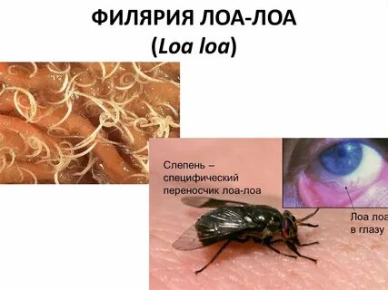 Филярии