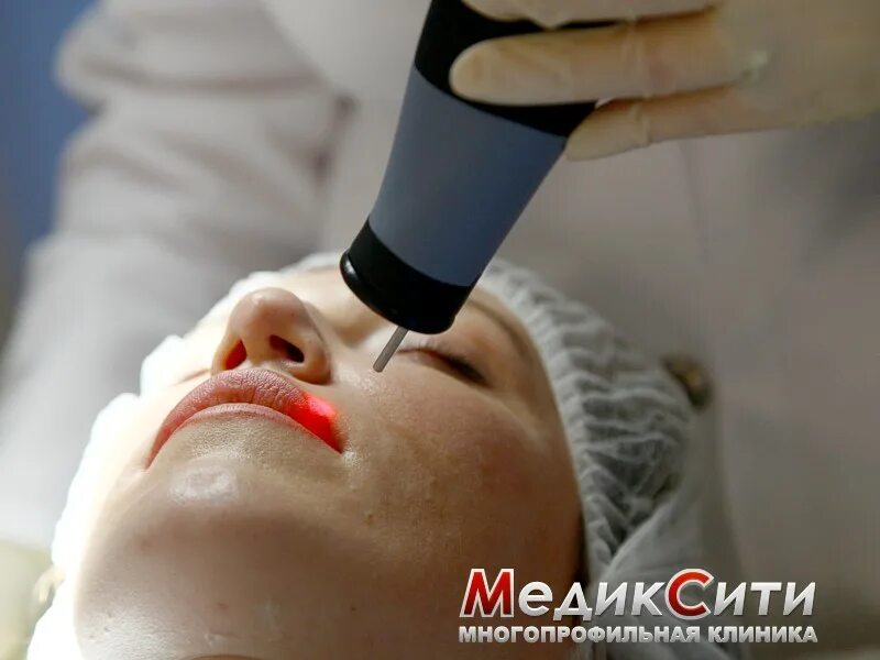 Лазерная шлифовка кожи цена skinlift ru. Лазерная дермабразия век. Лазерной шлифовки дермабразия. Абляционный лазер (эрбиевый).