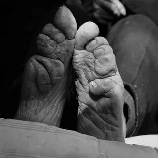 Chinese feet