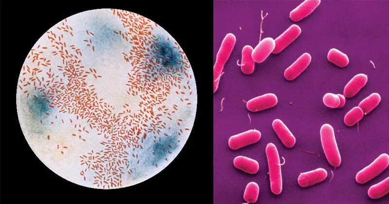 Haemophilus influenzae в носу. Палочка инфлюэнцы микробиология. Бактерии Haemophilus influenzae. H influenzae микробиология. Гемофильная палочка.