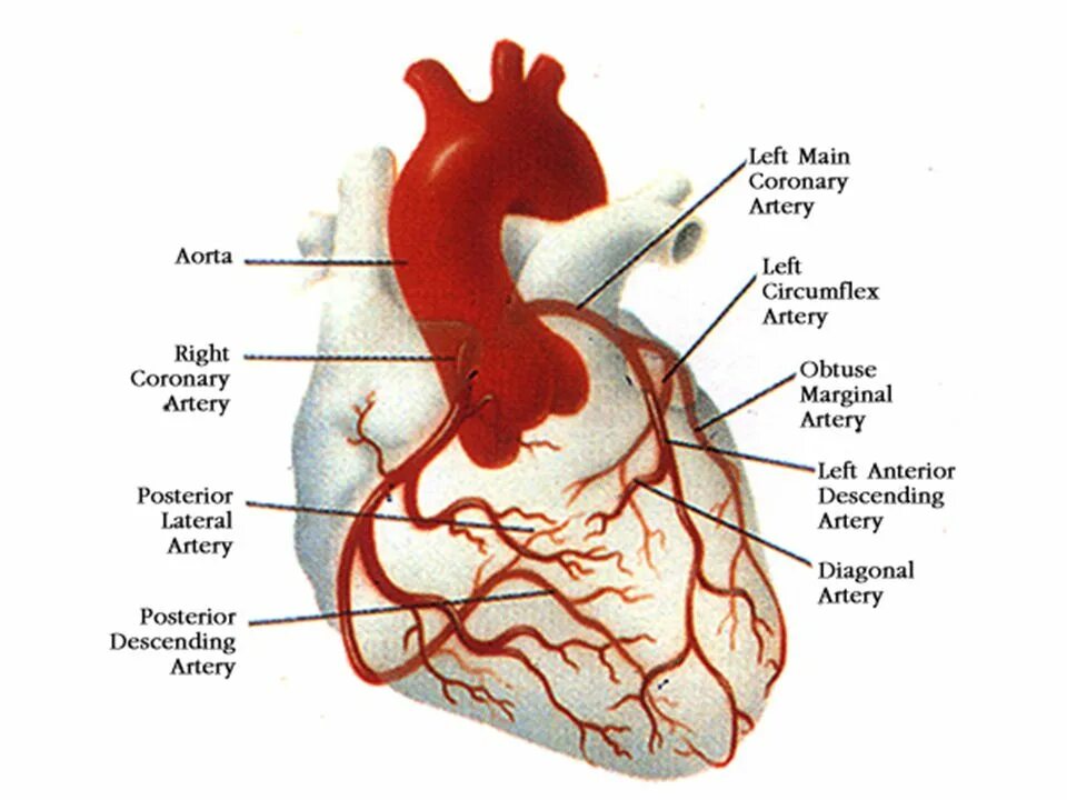 St segment elevation. Left main coronary artery. Left main. Left main. Left main coronary artery occlusion ecg.