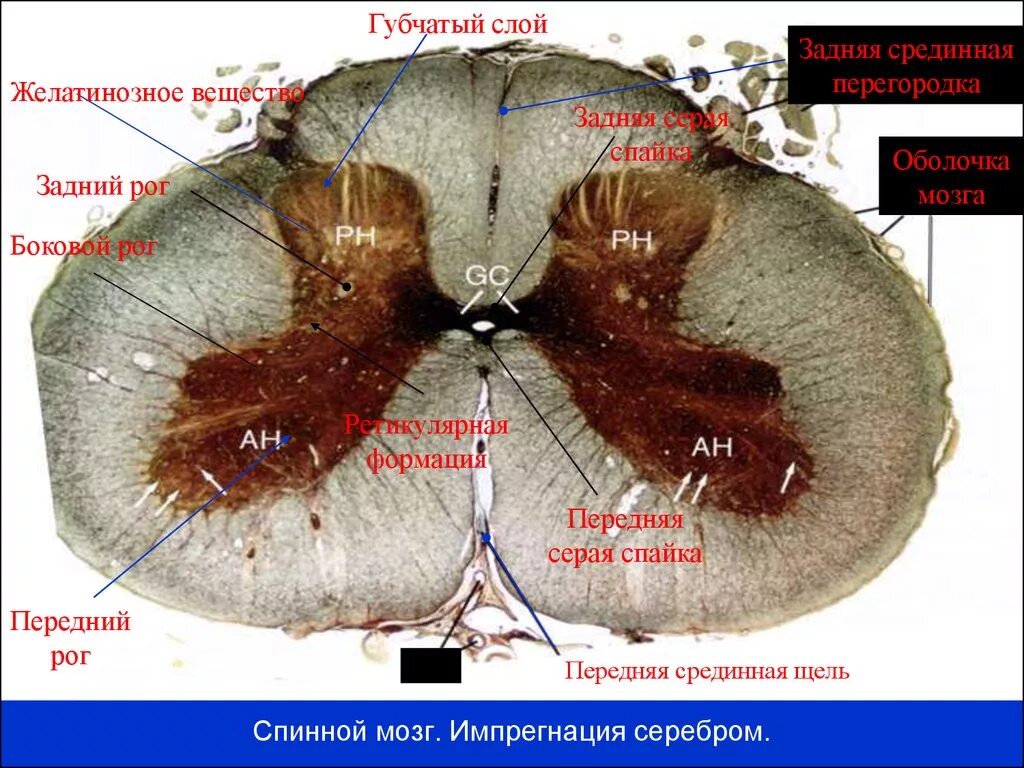 Задняя серая спайка спинного мозга. Препарат спинной мозг спайки. Передняя спайка спинного мозга. Задние рога спинного мозга гистология. Задний рог серого вещества спинного мозга