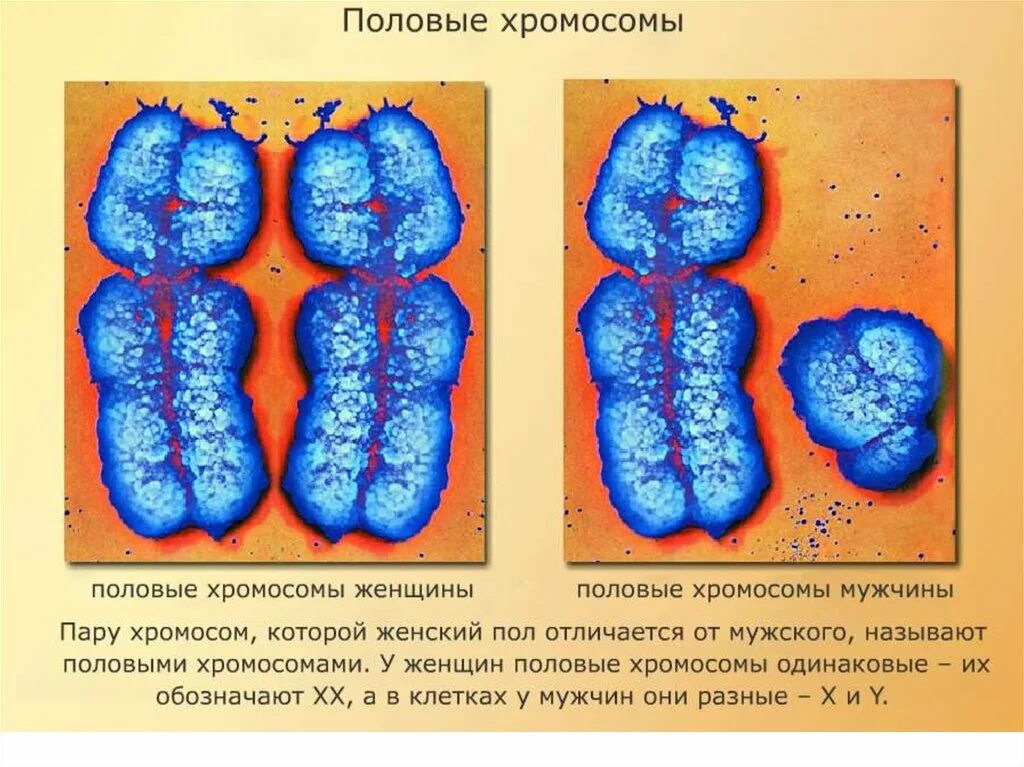 Вторая х хромосома. Половые хромосомы. 2 Половые хромосомы. Патологии женских половых хромосом. Половых хромосом у человека.