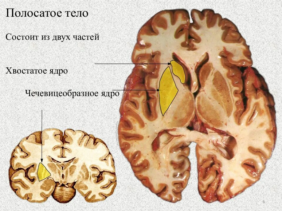 Хвостатое ядро мозга. Полосатое тело хвостатое и чечевицеобразное ядро. Чечевицеобразное ядро. Чечевицеобразное ядро головного мозга. Чечевице образное ядрол.