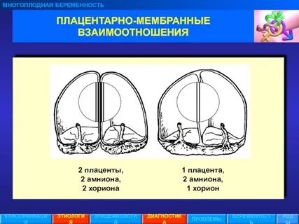 Многоплодная беременность тесты с ответами