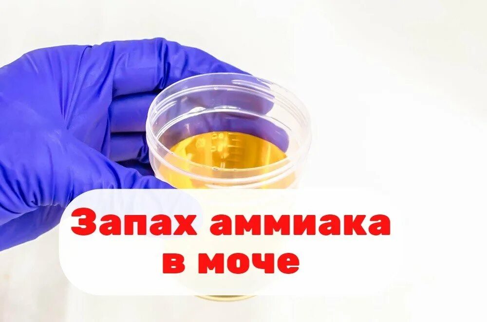 Моча воняет аммиаком. Аммиак в моче. Аммиачный запах мочи. Моча сильно пахнет аммиаком