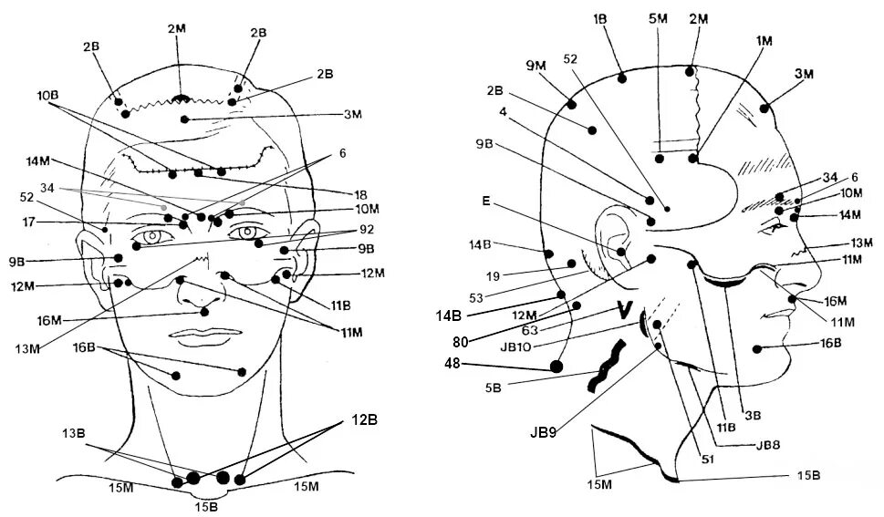 Болезненные точки на голове. Акупунктура тела человека схема болевые точки. Болевые точки на голове рефлексотерапия. Акупунктурные точки на теле человека схема для массажа. Точки акупунктуры на лице.