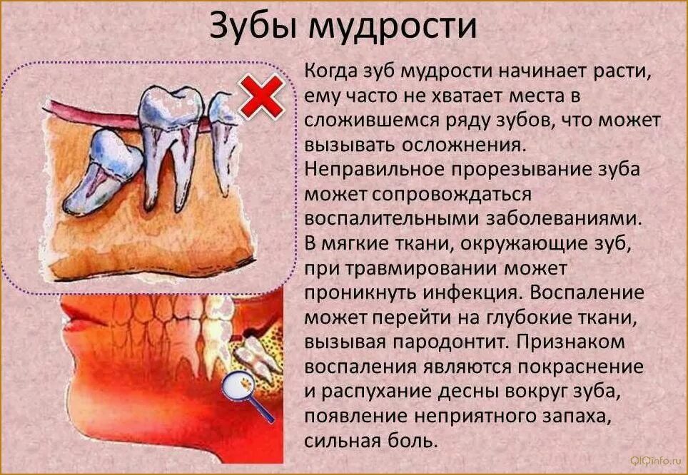 Ломит зубы причины и лечение