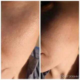 Спф после ретинола