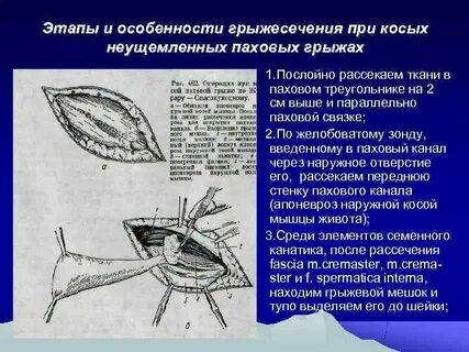 Грыжи грыжесечения