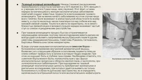 Как определить аппендицит самостоятельно у женщин