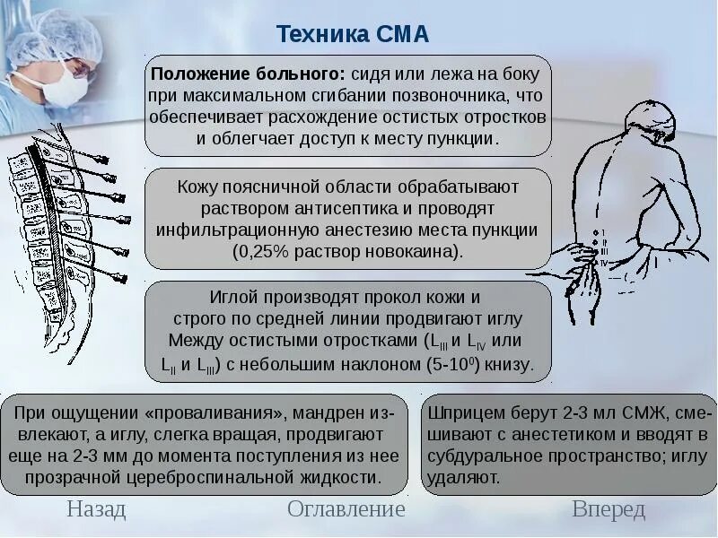 Спинная атрофия. Спинальная амиотрофия классификация. Спинальнт мышечныеатрофии. Спинальные амиотрофии типы. Спинальная мышечная атрофия.