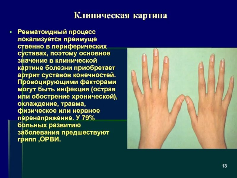 Как лечить ревматизм суставов