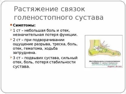 Растяжение голени мкб