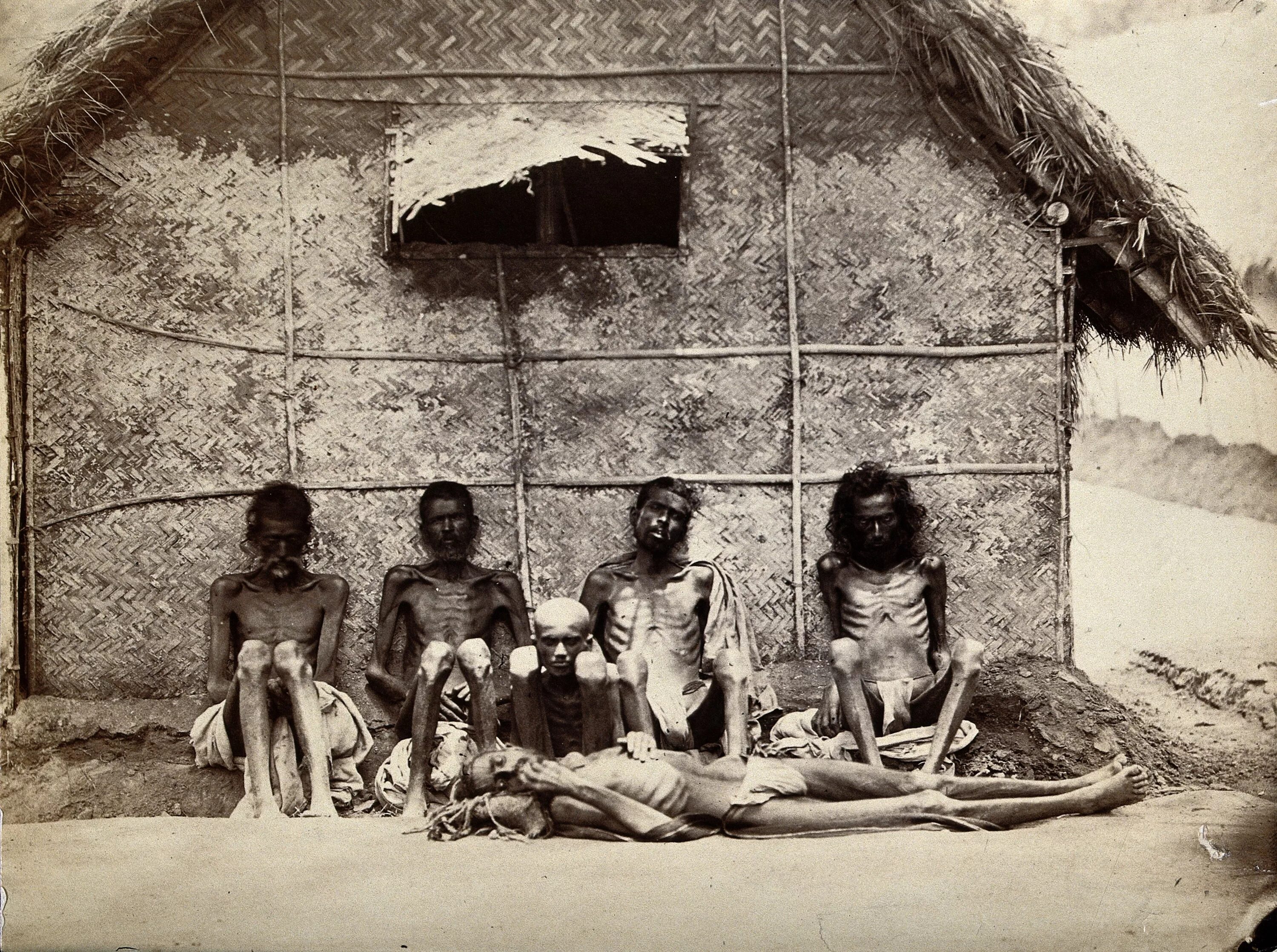 Самый большой голод. Голодающие в британской индии 1876-1878. голода в британской ￼ бенгалии в 1943 году.