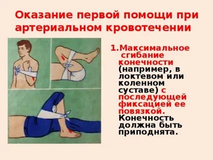 В случаях артериального кровотечения необходимо тест