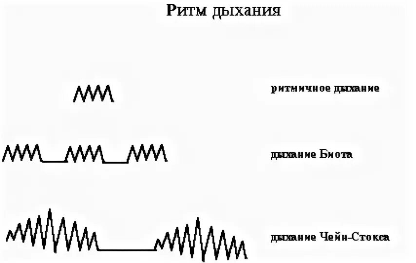 Воротник стокса